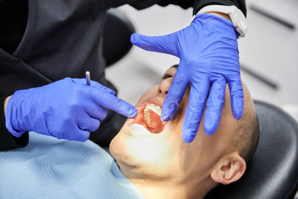 Best Emergency Tooth Extraction in Hillsboro, KS