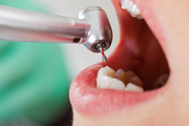 Best Emergency Treatment for Toothache in Hillsboro, KS